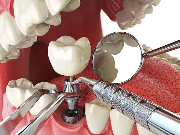 Best Emergency Dental Care for Abscessed Tooth in Marks, MS
